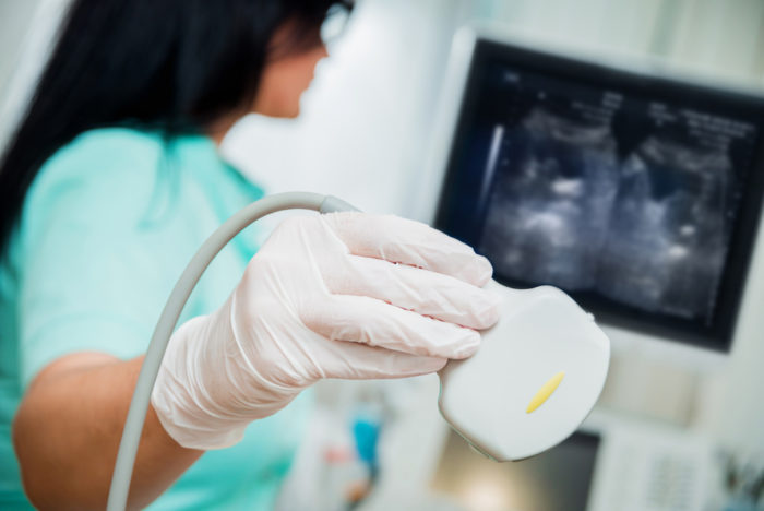 Ultrasound scanner in the hands of a doctor.