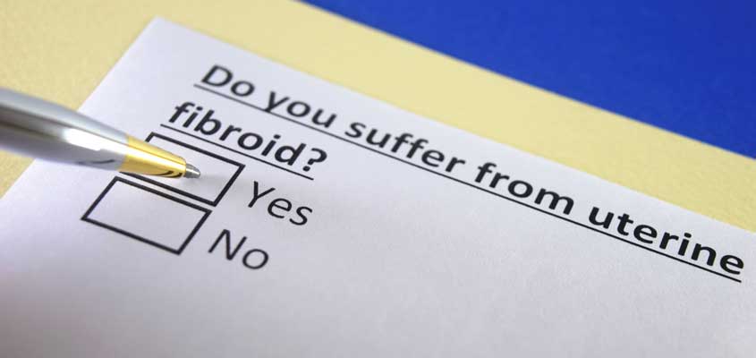 check list about fibroids